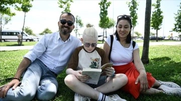 Albino çocuğu olan ebeveynler, akran zorbalığı ve ayrımcılığın son bulmasını istiyor