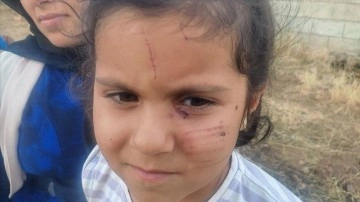 Şanlıurfa'da Köpek Saldırısı: Küçük Kız Yaralandı
